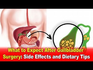 What to Expect After Gallbladder Surgery Side Effects & Dietary Tips