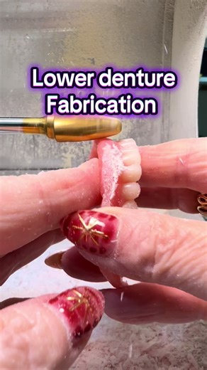 Understanding Dentures: Types and Fabrication