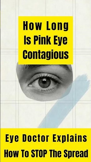 How Long Is Pink Eye Contagious For ? Ophthalmologist Dr. Nagori explains #pinkeye #conjunctivitis