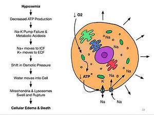 Cerebrovascular Disorders