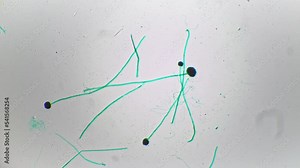 Whole mount of aspergillus filmed under microscope against bright field with 40 magnification. Dangerous fungus causing allergy learnt at laboratory with special scientific equipment to view structure