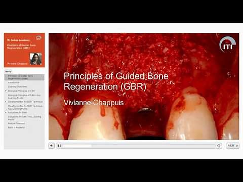Module Introduction: Principles of Guided Bone Regeneration (GBR) | Vivianne Chappuis