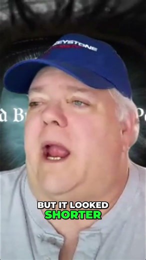 Charcot Foot: My Diabetes Nightmare Story #shorts