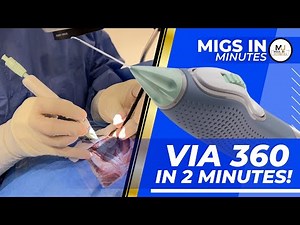 VIA360 Surgical System MIGS Procedure Overview | MIGS in Minutes #migs #glaucomasurgery
