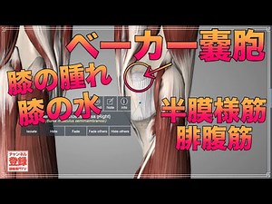 【ヒザ裏の腫れと痛み】ベーカー嚢胞(嚢腫)/膝窩嚢胞William Morrant Baker腓腹筋半膜様筋滑液包《ひざ痛専門整体院 京四郎 -KYOSIRO-》