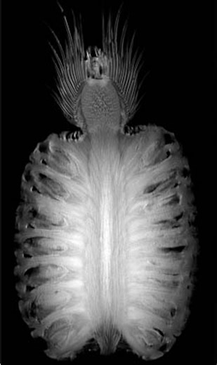 FLASH vs. EPI – Functional MRI: Basic principles