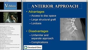 L5-S1 Fusion Options: Approach, Interbody Support and Graft Options