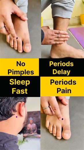 Curing Naturally on Instagram: "Boosting wellness through acupressure! 🌸✨ Discover these powerful points for clear skin, period relief, better sleep, and a healthy cycle. Follow @curing.naturally certified yoga teacher #AcupressurePoints #NoMorePimples #PeriodsRelief #SleepBetter #HolisticHealing #WellnessTips #HealthyLiving #NaturalRemedies #AcupressureForHealth #ClearSkinJourney #MenstrualHealth #SleepTips #PimplesNoMore #WomenWellness #CycleCare #PainReliefTips #SelfCareRoutine #HealingHands
