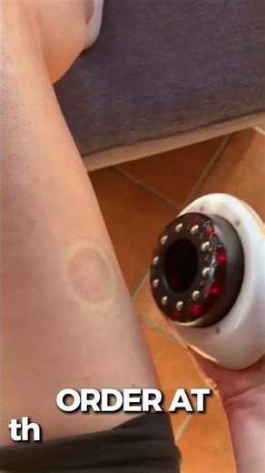 How to get rid of cellulite in 7 days? 😱 CelloErase massager review! ✨