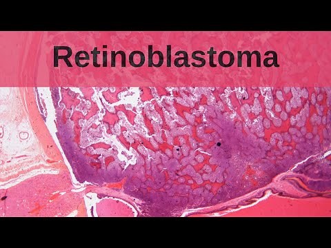 Retinoblastoma - Pathology mini tutorial
