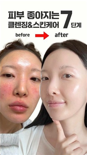 Must-watch for anyone with bad skin🙋🏻‍♀️ 7-step skin reset routine (all-in-one cleansing to skinc...