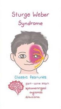 Sturge Weber Syndrome