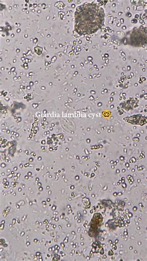 Understanding Giardia lamblia Cyst in Stool