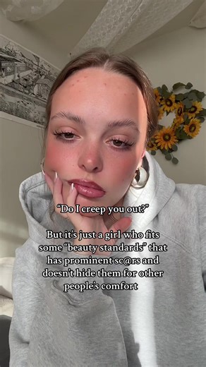 Over 3 years clean could not be happier. I would rather take weird looks than forfeit my right to wear cute clothes and look a certain way. Anyone can struggle.