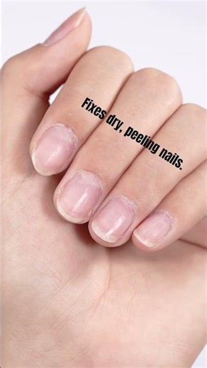 Nail Cuticle Cream | Fixing Dry & Peeling Cuticles: The Guide For Everyone #cuticlecare #manicure