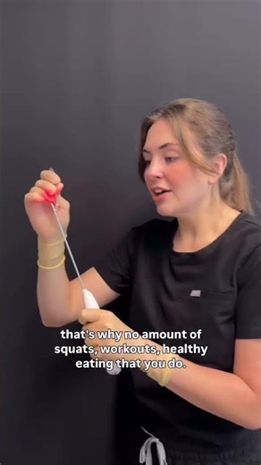 What ACTUALLY causes cellulite?