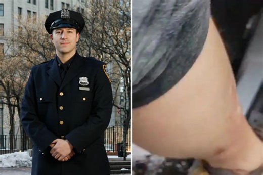 NYPD cop suing McDonald’s over scalding-hot coffee burn that caused his skin to ‘peel off’ — echoing famous ‘90s case