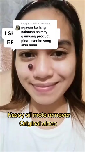 Kasoy Cream Mole Remover Feedback & Reviews