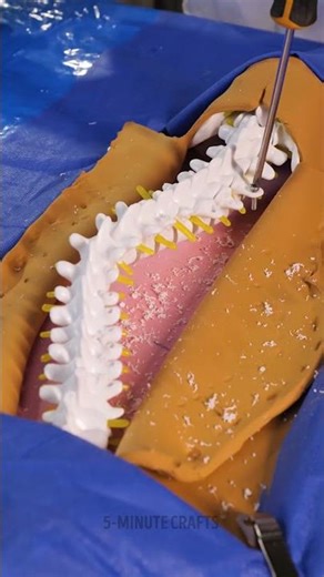 Trying a Cervical Surgery Simulation for Fun 😱