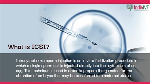 Flertility on Instagram: "Intracytoplasmic Sperm Injection (ICSI) is a form of assisted reproductive technology used to treat male infertility. It involves the direct injection of a single sperm into an egg to increase the chances of fertilization. ICSI is a highly specialized procedure that requires skilled technicians and advanced laboratory equipment. #ICSI #maleinfertility #reproductivemedicine #fertilitytreatments #assistedreproductive technology #IVF #sperminjection #embryology #familyplan