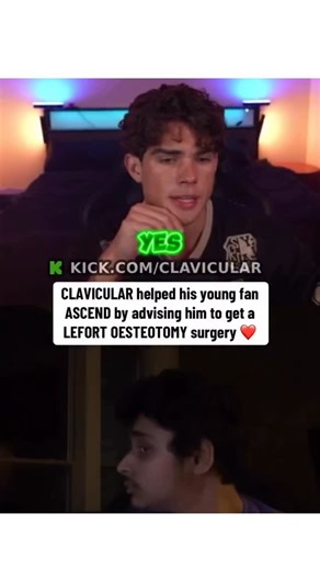 Streamz Culture on Instagram: "A LeFort osteotomy is a surgical procedure used to reposition the upper jaw (maxilla) to improve facial balance, bite alignment, airway function, and overall symmetry. It’s one of the cornerstone operations in orthognathic (jaw) surgery, most commonly performed as a LeFort I, where the surgeon makes precise cuts to the midface so the upper jaw can be moved forward, raised, lowered, or subtly rotated. This controlled repositioning can correct underbites, open bites,