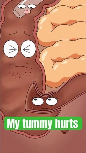 What exactly is the condition of intussusception ? #animation #funny #shorts