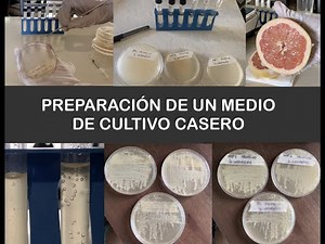 Preparación De Un Medio Casero Para La Obtención De Levaduras (Saccharomyces cerevisiae)