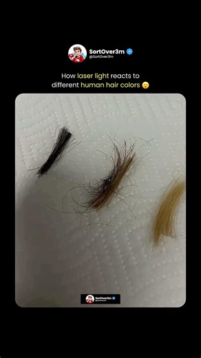 How Hair Color Changes Laser Energy Absorption 😮