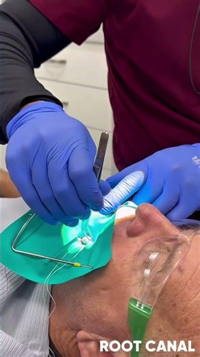 Root Canal Process | Lakes Dental Group