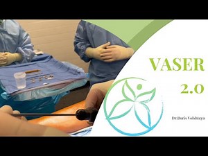 Lipedema - Liposuction With Vaser 2.0 - Dr. Boris Volshteyn