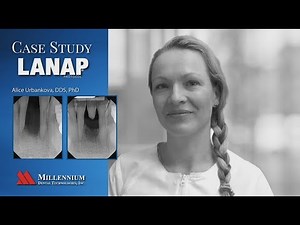 CASE STUDY - LANAP Treatment Saves Completely Loose Tooth