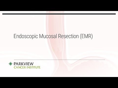 Endoscopic Mucosal Resection (EMR)