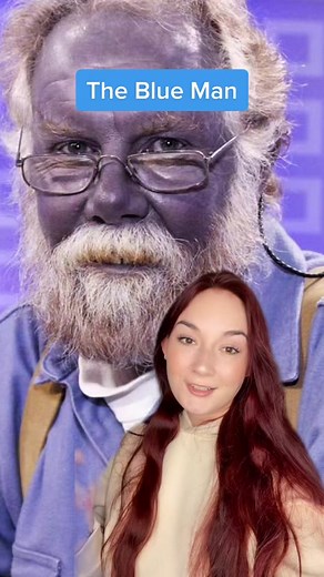 The True Story of the Blue Man - Unveiling the Mystery Behind the Blue Skin