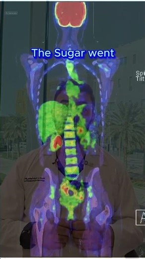 التصوير المقطعي بالإصدار البوزيترونيPositron Emission Tomography (PET Scan) – Part 1 of 4