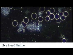 Platelets - Live Blood Analysis Training Course