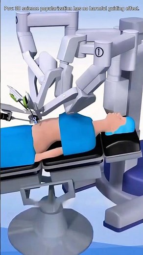 How Gallbladder Removal Surgery is Performed? (3D Animation) #3danimation #doctor #foryou #ytshorts