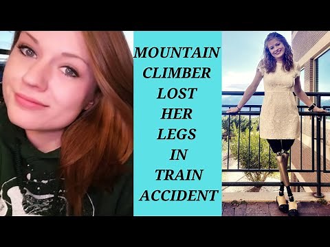 Woman Lost Legs In Train Accident Gets New Prosthetic Legs