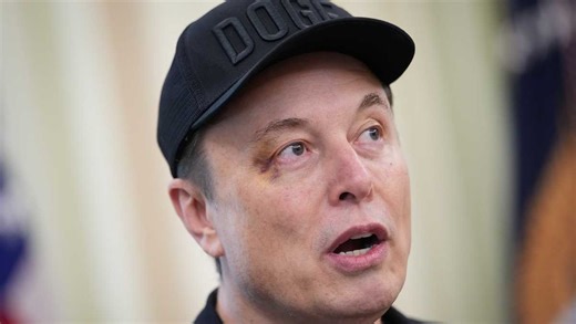 Elon Musk appeared at exit press conference with black eye. Here's what he said happened