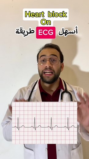 Understanding Heart Conduction Block: Mobitz 1 vs. Mobitz 2 on ECG