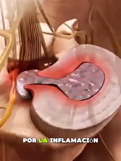 #columna #dolordeespalda #dolordecolumna #dolorlumbar #columnabloqueada #columnavertebral #sinenviar #dolor #escoliosis #cirugía #cirugíadecolumna #doloresdeespalda #quiropráctica #fisioterapia #médico #hospital #hospitalización #oración #oraciónpoderosa #Dios #Jesús