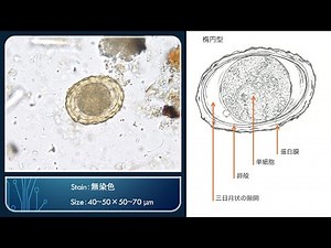 [寄生虫かるた] 回虫 受精卵【豆構造解説：字幕】