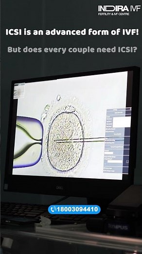 Does Every Couple Need ICSI? Read to Know! | Indira IVF