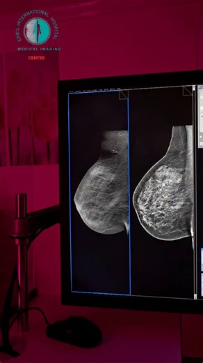 EIH Advanced Medical Imaging Group on Instagram‎: "2D & 3D mammography (tomosynthesis) وێـنەیەکـــــی ڕوونتر .... چارەســـەرێکـی زووتر .... ● کوردی / عربي/ English (بەشی تیشک) لە (نەخۆشخانەی اربیل انترناشنال ) بە پێشکەوتووترین ئامێری پشکنینی سەردەم ٢٤ کاژمێری رۆژ له ٧ رۆژی هەفتە کراوەیە بە گونجاوترین نرخ بەبێ گۆڕانی نرخ . ✅ ١. ئامێری لەرەرەی موگناتیسی . ✅ ٢. ئامێری سیتی سکان. ✅ ٣. ئامێری تیشکی دیجیتاڵی. ✅ ٤. پشکنینی چری ئێسک. ✅ ٥.پشکنینی تیشکی مەمک . ✅ ٦. پشکنینی فەرمانەکانی هەرس و میزەرۆ . ✅ ٧.