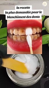 La cette la plus demandée pour le blanchiment dentaire 🦷 #dentaire #dentblanche | Astuces & Recettes