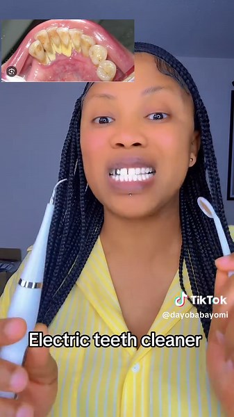 Electric Teeth Cleaner for Effective Plaque Removal and Dental Care