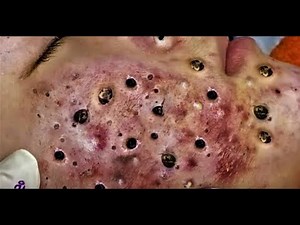 Relax Every Day With Video Loan Nguyen #114