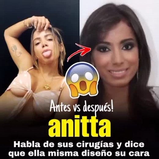 Anitta: Antes y Después en Entrevista Exclusiva