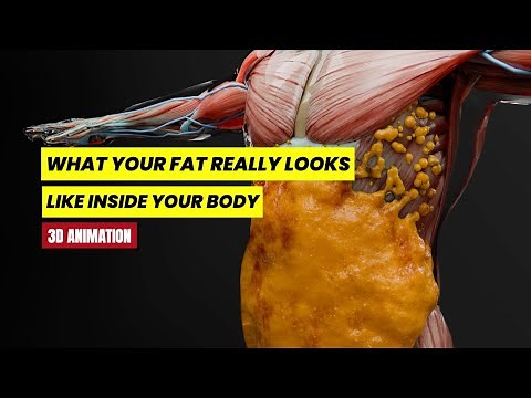 Fat Surrounding Your Organs? Here's What's Actually Happening