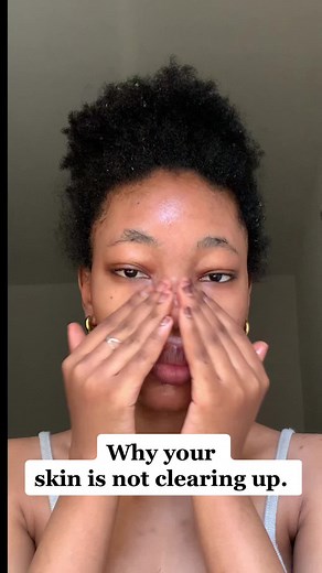 I’m using the tea tree exfoliating facial wash from @beauty_formulas It’s my favorite cleanser because it’s gentle on my skin and doesn’t leave my skin feeling dry. It’s very affordable (below N2000) It contains salicylic acid and tea tree oil for acne. You should try it out if you’re looking to buy a new cleanser. #skincare #skintok #acne #hyperpigmentation #skincareroutine #skincaretips #skin #clearskintips #viral #fyp #fypシ #beauty #beautytips #skincarenigeria