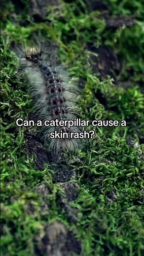 Can a caterpillar cause a skin rash? 🐛